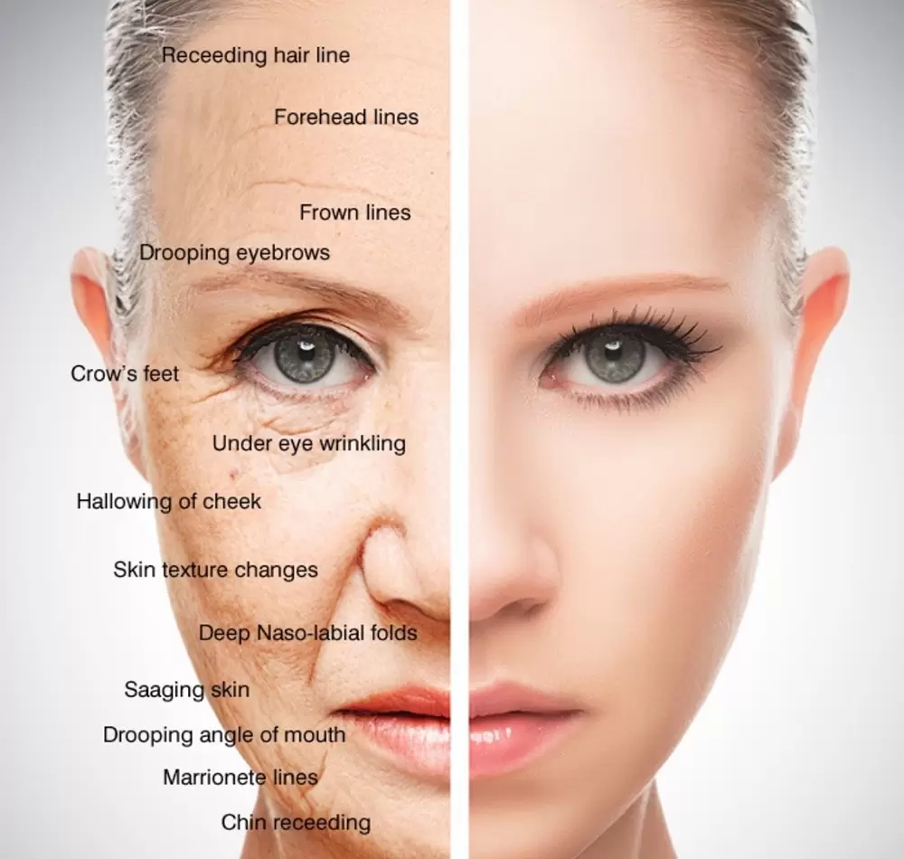 Non-operative blepharoplasty Rania Beauty House